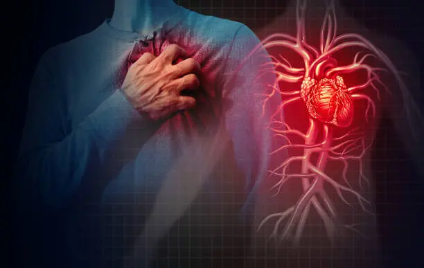 Myocardial Infarction Quiz cover photo