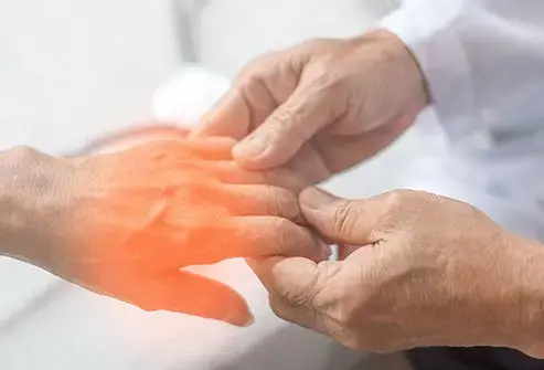 Peripheral Neuropathy cover photo